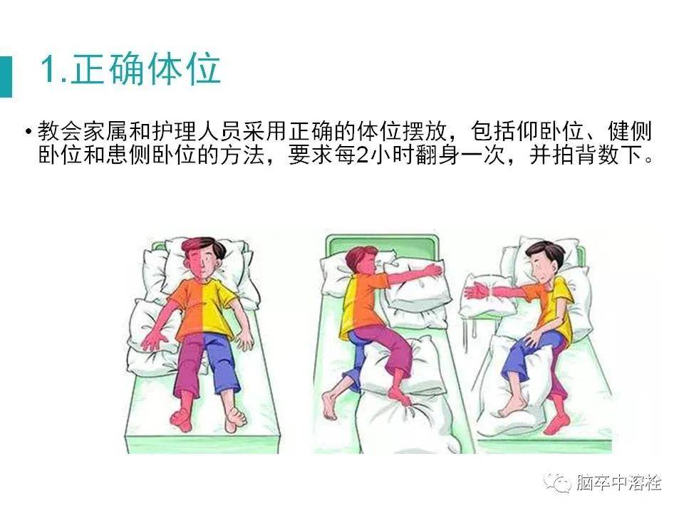 卒中康复|避开脑卒中康复治疗常见误区，踏上健康之路