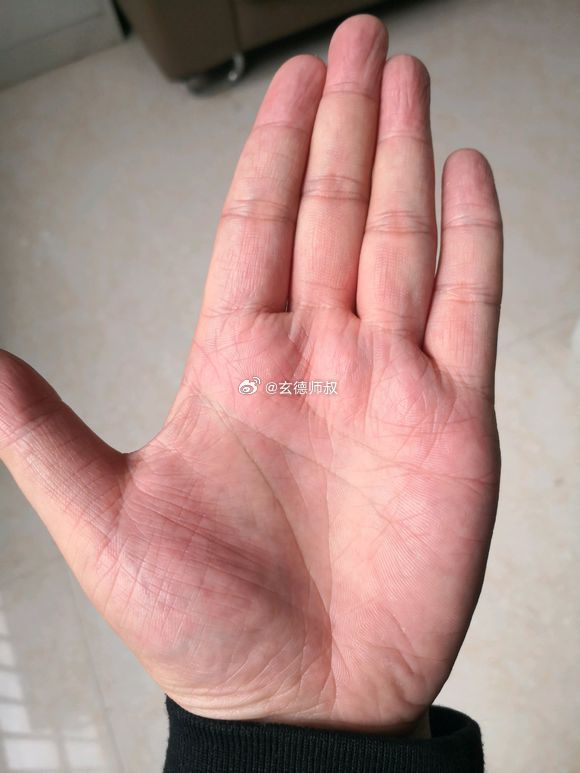 手臂里的“生命线”