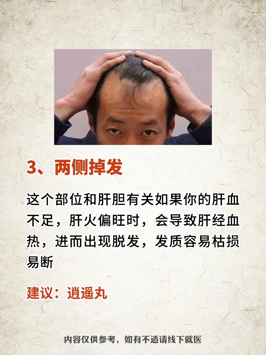 头发爱出油是疾病